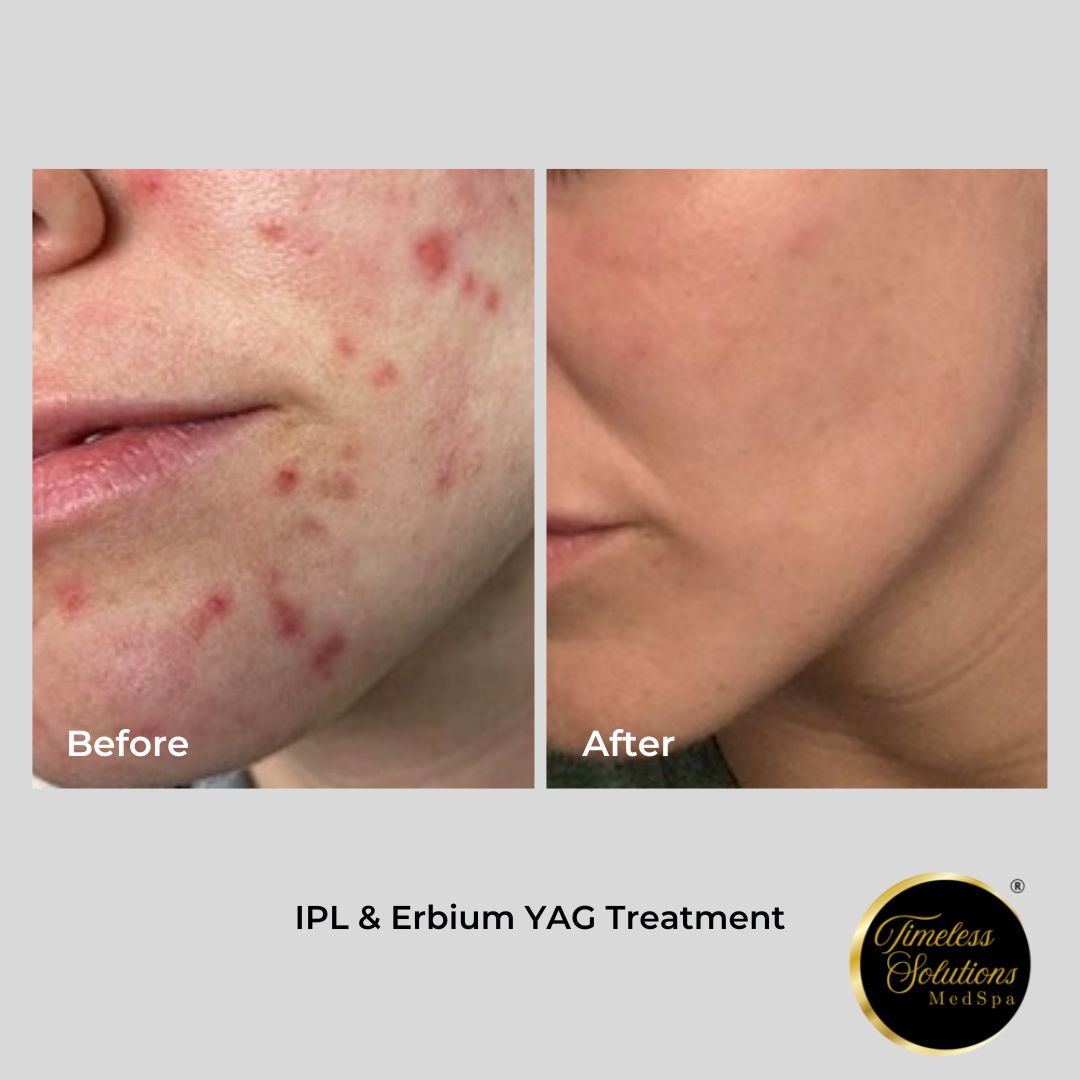 Improve-Rejuvenate Skin