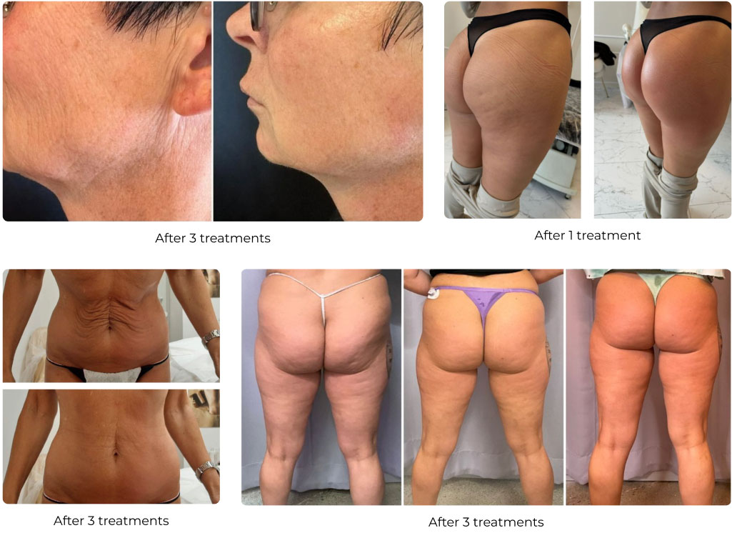 T-Shape2 Results