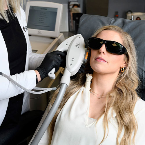 IPL Laser